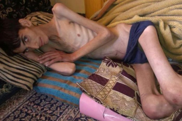 Syria: UN accused of failing to help starving Syrians - Madaya